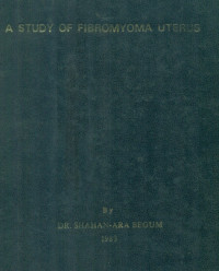 Image of A Study Of Fibromyoma Uterus