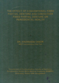 Image of The Effect Of Conventional Fixed Partial Denture And Cantilever Fixed Partial Denture On Periodontal Health