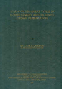 Image of Study On Different Types Of Luting Cement Used In Dowel Crown Cementation