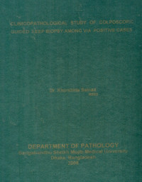Image of Clinicopathological Study Of Colposcopic Guided Leep Biopsy Among Via Positive Cases