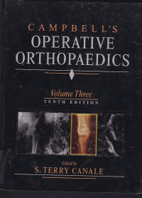 Image of Campbell's operative orthopaedics