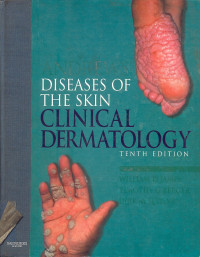 Image of ANDREWS' DISEASES OF THE SKIN CLINICAL DERMATOLOGY