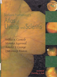 Image of Sankara Nethralaya,s Atlas of Uveitis and Scleritis