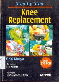 Image of Step by Step Knee Replacement