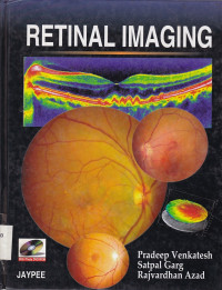 Image of Retinal imaging