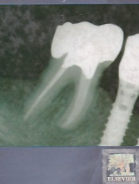 Image of Pathways of the pulp