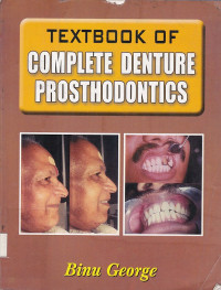 Image of Trxtbook of Complete Denture Prosthodontics