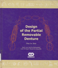 Image of Design of the Partial Removable Denture