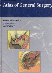 Image of Atlas of General Surgery