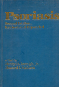 Image of Psoriasis