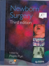 Image of Newborn Surgery