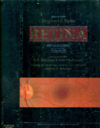 Image of Retina