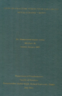 Image of Study  On  Fracture  Strength  Of  Collarless  Metal-Ceramic  Crown