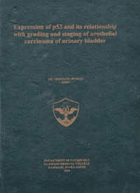 Image of Expression of p53 and its Relationship with Grading and Staging of Urothelial Carcinoma of Urinary Bladder