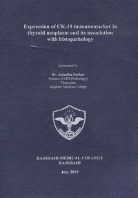 Image of Expression of CK-19 immunomarker in thyroid neoplasm and its association with histopathology