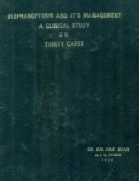 Image of Blepharoptosis And It's Management A Clinical Study On Thirty Cases