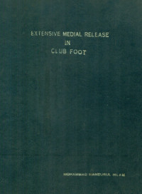 Image of Extensive Medial Release In Club Foot