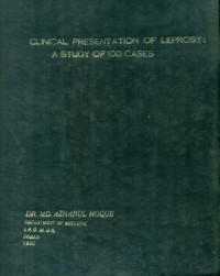 Image of Clinical Presentation Of Leprosy : A Study Of 100 Cases